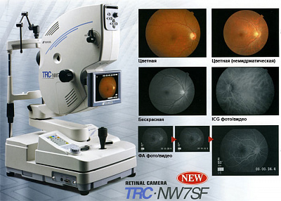 Ретинальная камера TRC-NW7SF MarkII для офтальмологии выбрать в каталоге и купить оптом и в розницу по цене от производителя Topcon (Япония) в Компании "ИРИС-М". Звоните сейчас +7 (495) 798-42-23 или 8 (800) 200-90-23. Доставка по России.